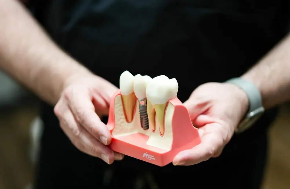 A clinician holding a model of a dental implant with a crown.